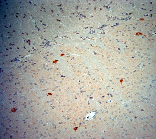 nNOS Antibody in Immunohistochemistry (Paraffin) (IHC (P))