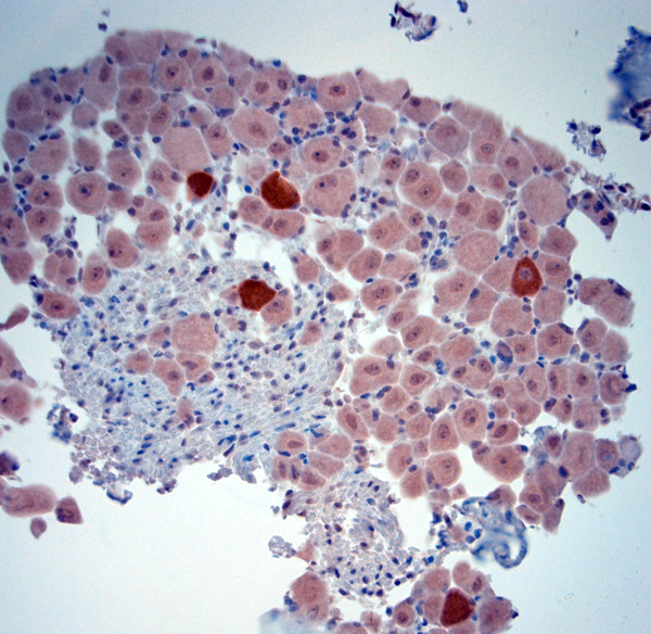 nNOS Antibody in Immunohistochemistry (Paraffin) (IHC (P))