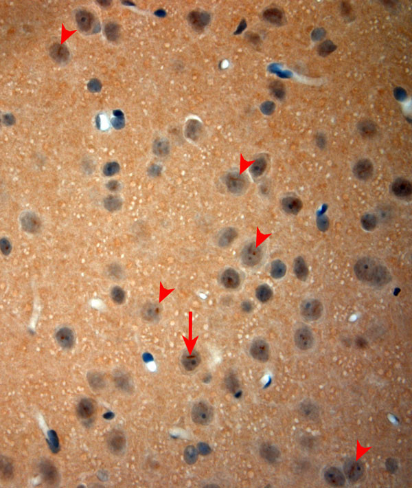 NGF Antibody in Immunohistochemistry (Paraffin) (IHC (P))