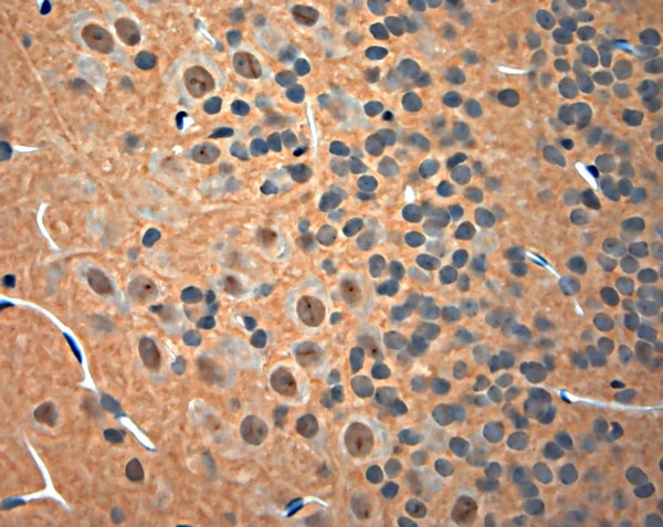 NGF Antibody in Immunohistochemistry (Paraffin) (IHC (P))