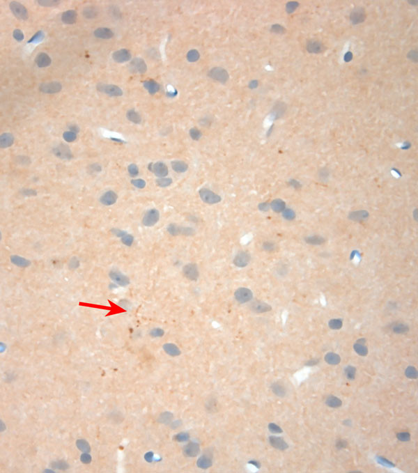 NGF Antibody in Immunohistochemistry (Paraffin) (IHC (P))