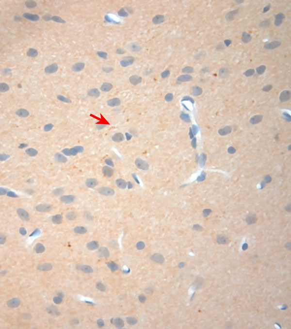 NGF Antibody in Immunohistochemistry (Paraffin) (IHC (P))