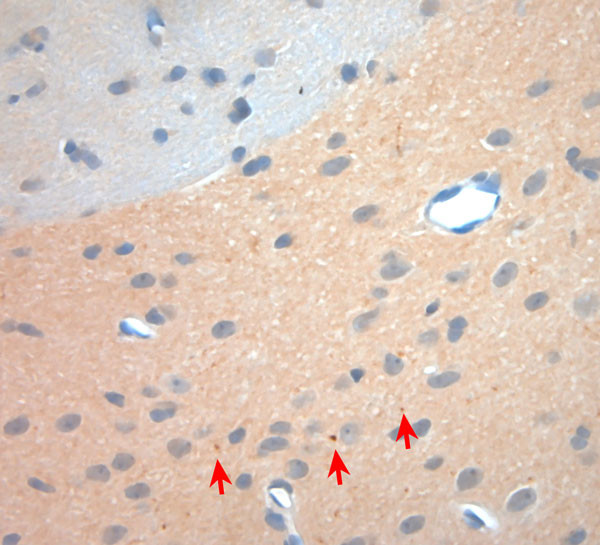 NGF Antibody in Immunohistochemistry (Paraffin) (IHC (P))