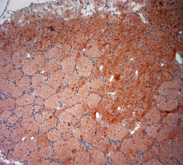 NeuN Antibody in Immunohistochemistry (Paraffin) (IHC (P))