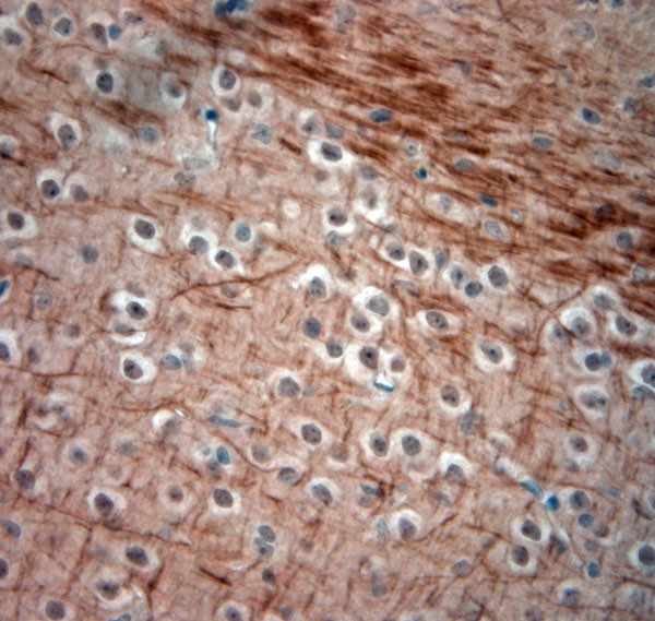 200 Neurofilament Antibody in Immunohistochemistry (Paraffin) (IHC (P))