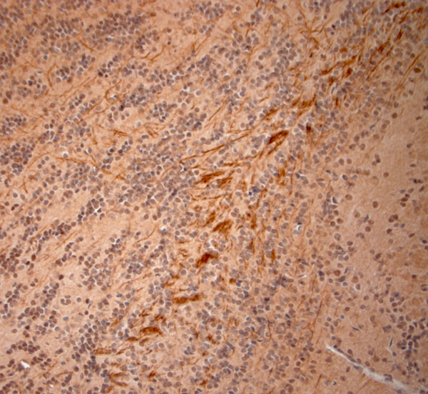 200 Neurofilament Antibody in Immunohistochemistry (Paraffin) (IHC (P))