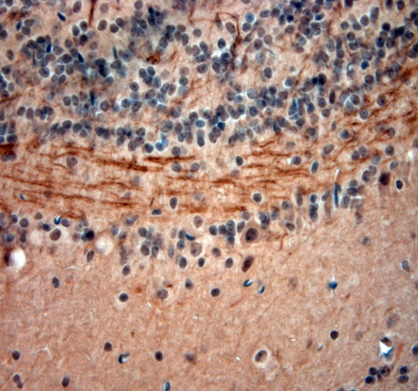 200 Neurofilament Antibody in Immunohistochemistry (Paraffin) (IHC (P))