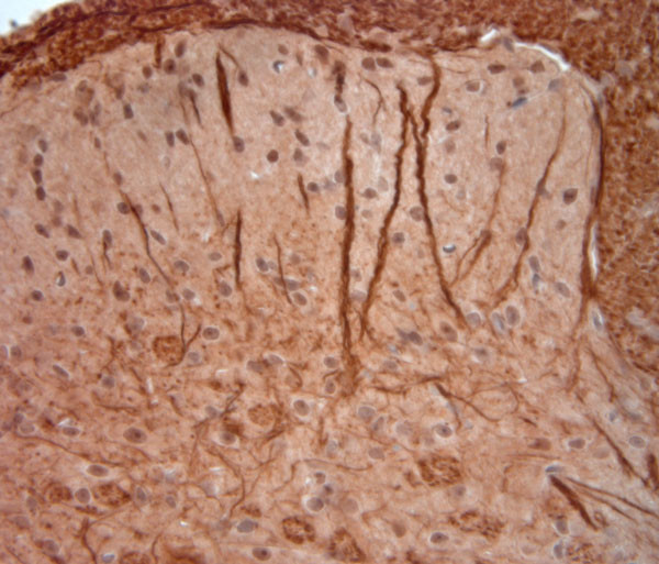 200 Neurofilament Antibody in Immunohistochemistry (Paraffin) (IHC (P))