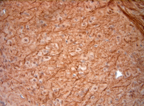 200 Neurofilament Antibody in Immunohistochemistry (Paraffin) (IHC (P))