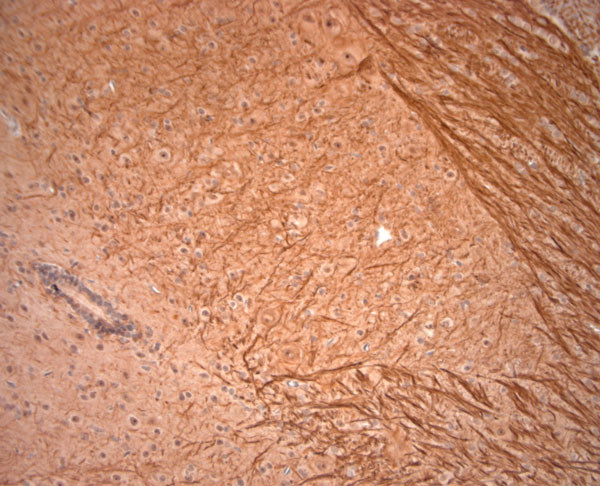 200 Neurofilament Antibody in Immunohistochemistry (Paraffin) (IHC (P))