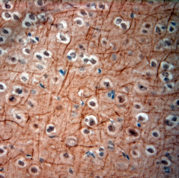 200 Neurofilament Antibody in Immunohistochemistry (Paraffin) (IHC (P))