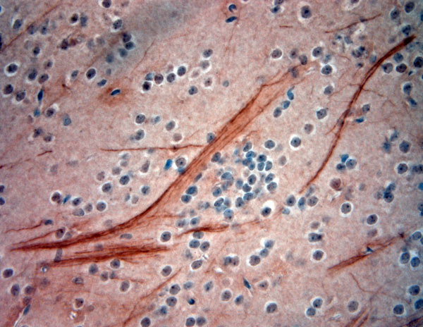 200 Neurofilament Antibody in Immunohistochemistry (Paraffin) (IHC (P))