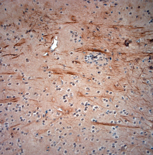 200 Neurofilament Antibody in Immunohistochemistry (Paraffin) (IHC (P))