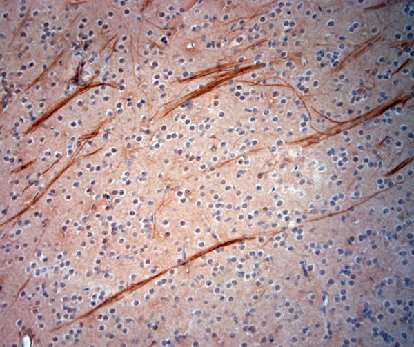 200 Neurofilament Antibody in Immunohistochemistry (Paraffin) (IHC (P))