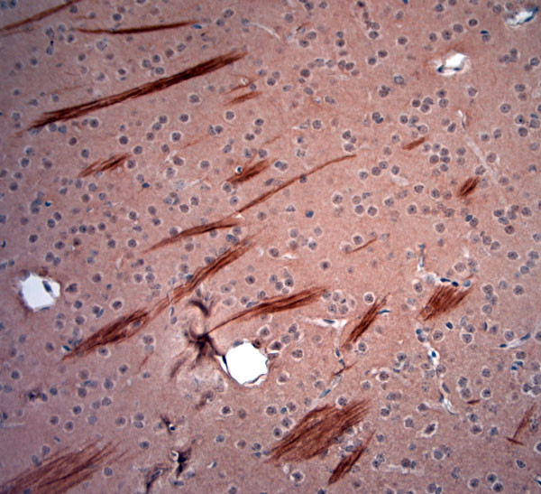 200 Neurofilament Antibody in Immunohistochemistry (Paraffin) (IHC (P))