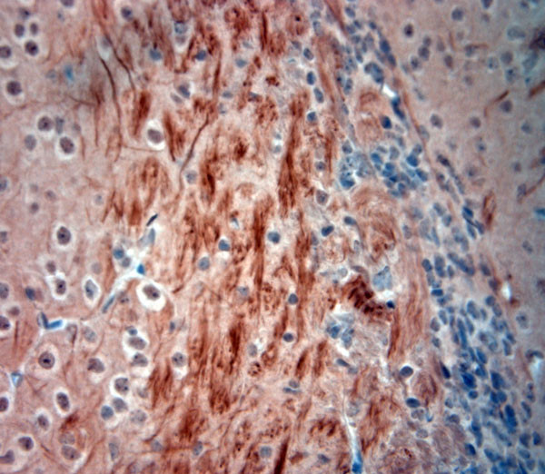 200 Neurofilament Antibody in Immunohistochemistry (Paraffin) (IHC (P))