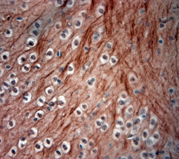 200 Neurofilament Antibody in Immunohistochemistry (Paraffin) (IHC (P))