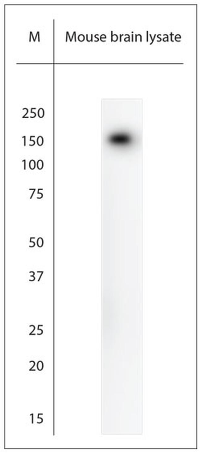 200 Neurofilament Antibody in Western Blot (WB)