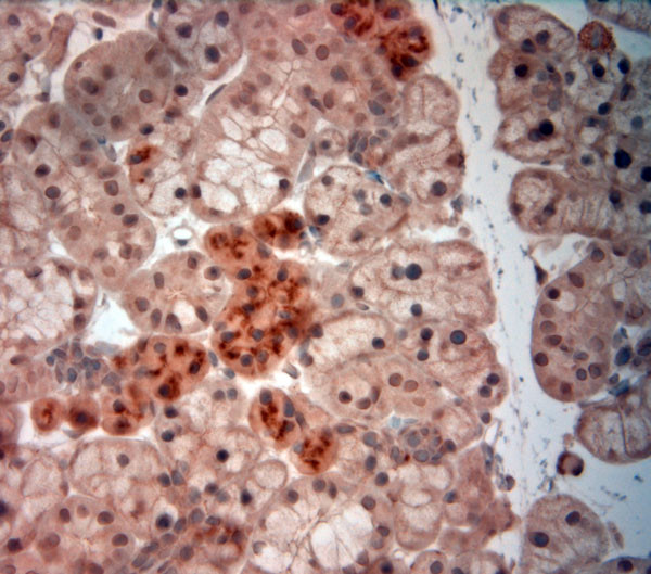 NGF Antibody in Immunohistochemistry (Paraffin) (IHC (P))