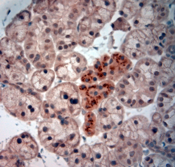 NGF Antibody in Immunohistochemistry (Paraffin) (IHC (P))