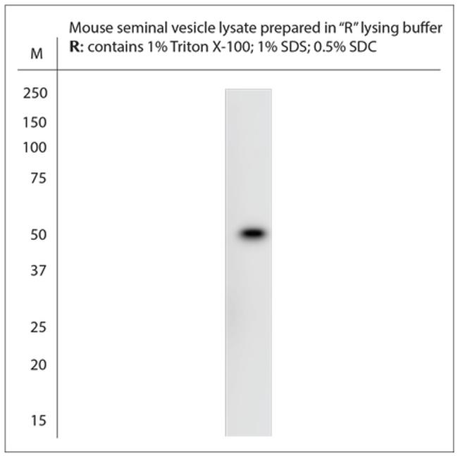 NMBR Antibody in Western Blot (WB)