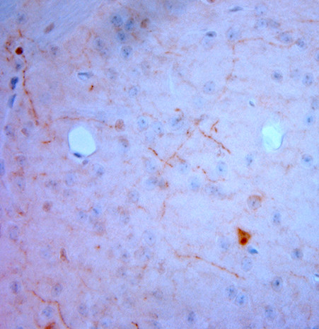 NPY Antibody in Immunohistochemistry (Paraffin) (IHC (P))