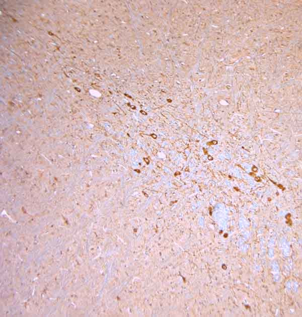 nNOS Antibody in Immunohistochemistry (Paraffin) (IHC (P))