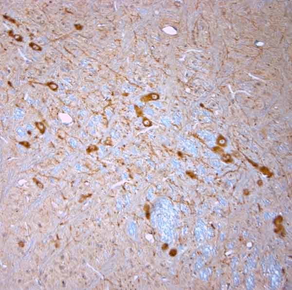 nNOS Antibody in Immunohistochemistry (Paraffin) (IHC (P))