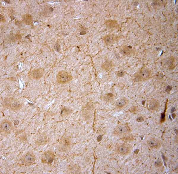 nNOS Antibody in Immunohistochemistry (Paraffin) (IHC (P))