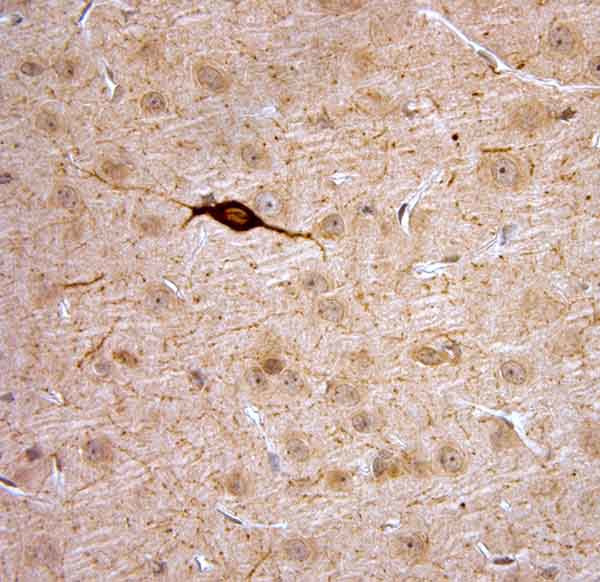 nNOS Antibody in Immunohistochemistry (Paraffin) (IHC (P))