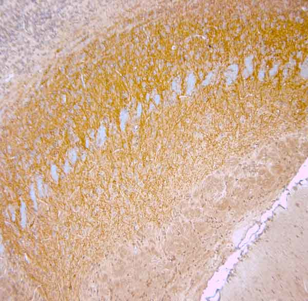 nNOS Antibody in Immunohistochemistry (Paraffin) (IHC (P))