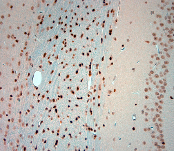 Olig2 Antibody in Immunohistochemistry (Paraffin) (IHC (P))