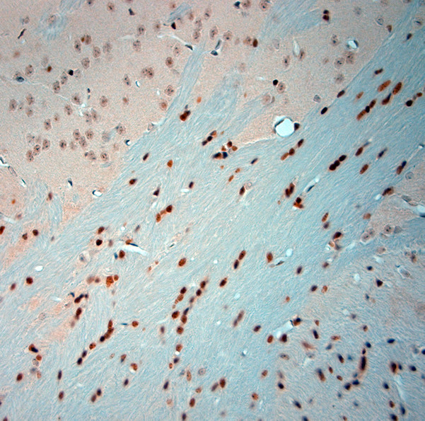 Olig2 Antibody in Immunohistochemistry (Paraffin) (IHC (P))