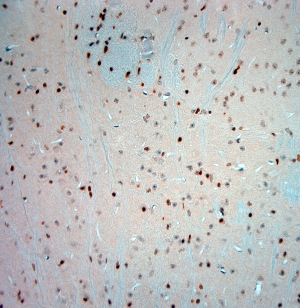 Olig2 Antibody in Immunohistochemistry (Paraffin) (IHC (P))