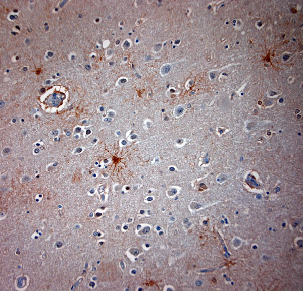 Orexin R2 Antibody in Immunohistochemistry (Paraffin) (IHC (P))