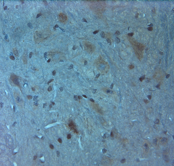 Orexin R2 Antibody in Immunohistochemistry (Paraffin) (IHC (P))