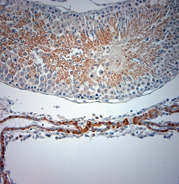 Optineurin Antibody in Immunohistochemistry (Paraffin) (IHC (P))