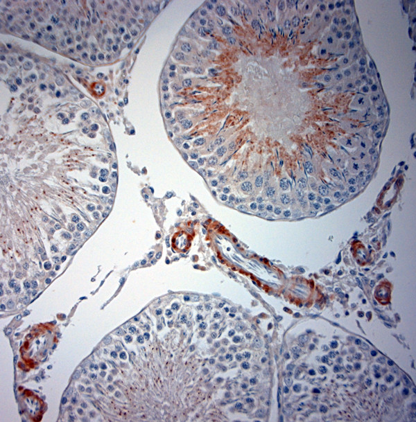 Optineurin Antibody in Immunohistochemistry (Paraffin) (IHC (P))