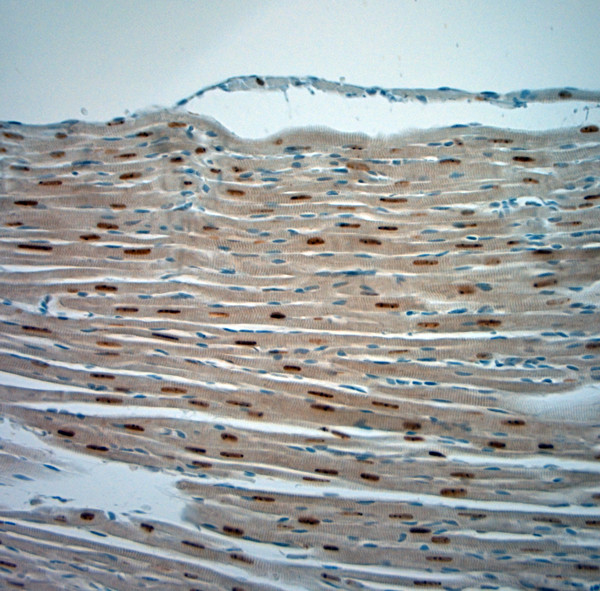 Optineurin Antibody in Immunohistochemistry (Paraffin) (IHC (P))