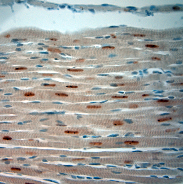 Optineurin Antibody in Immunohistochemistry (Paraffin) (IHC (P))