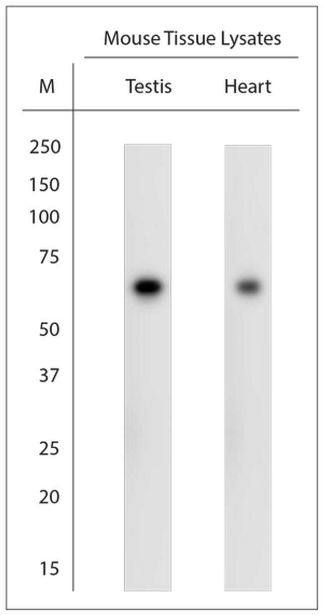 Optineurin Antibody in Western Blot (WB)