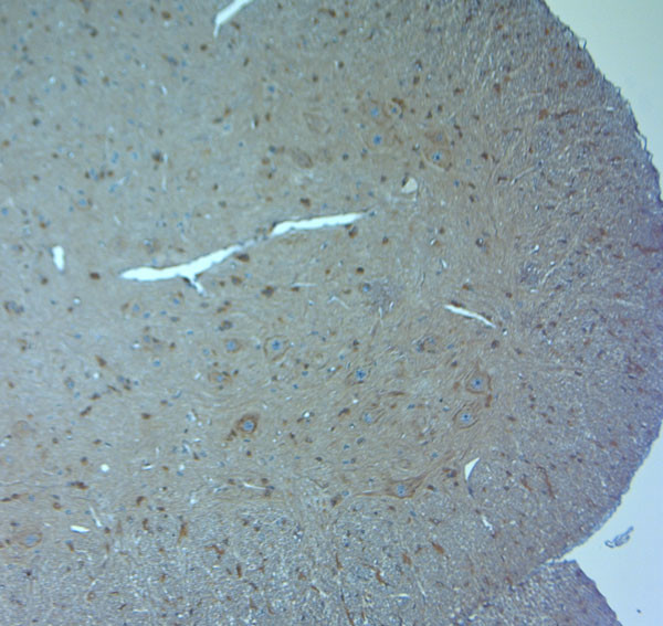 Orexin R2 Antibody in Immunohistochemistry (Paraffin) (IHC (P))