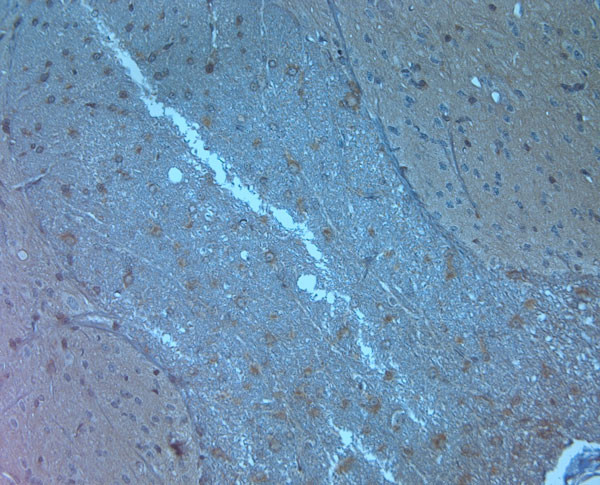 Orexin R2 Antibody in Immunohistochemistry (Paraffin) (IHC (P))