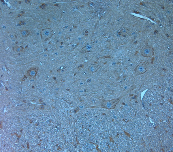 Orexin R2 Antibody in Immunohistochemistry (Paraffin) (IHC (P))