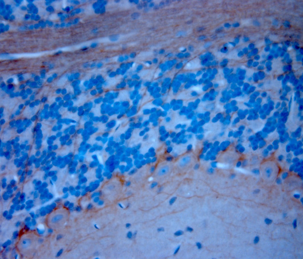 P2RX7 Antibody in Immunohistochemistry (Paraffin) (IHC (P))