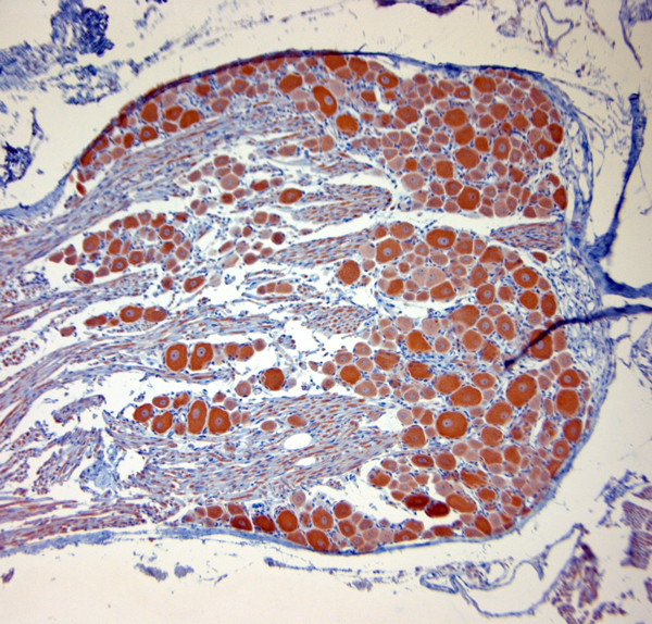 P2RX7 Antibody in Immunohistochemistry (Paraffin) (IHC (P))