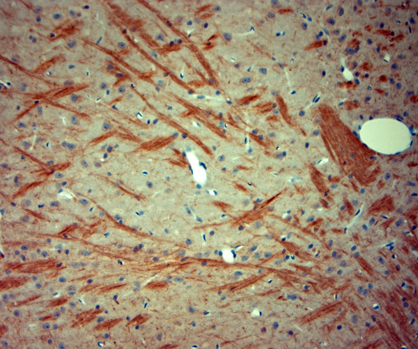 P2RX7 Antibody in Immunohistochemistry (Paraffin) (IHC (P))