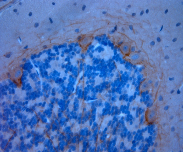 P2RX7 Antibody in Immunohistochemistry (Paraffin) (IHC (P))