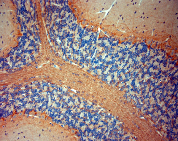 P2RX7 Antibody in Immunohistochemistry (Paraffin) (IHC (P))