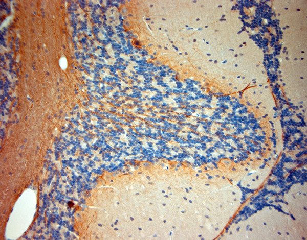 P2RX7 Antibody in Immunohistochemistry (Paraffin) (IHC (P))